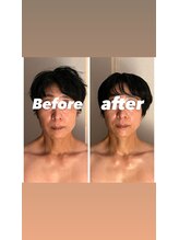 ニコジャム(nicojam)/面長、凹凸がツルンと若見え☆