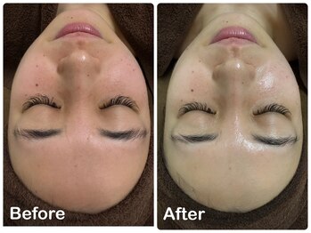 ケー(K)/ホワイトピーリング