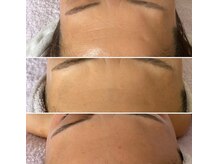 リュミエール(Lumie're)/シワケア