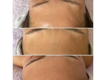 リュミエール(Lumie're)/シワケア