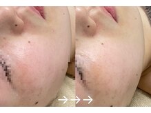 フロラスキン 上野店(florasKIN)/