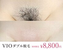 アールビューティー(R Beauty)