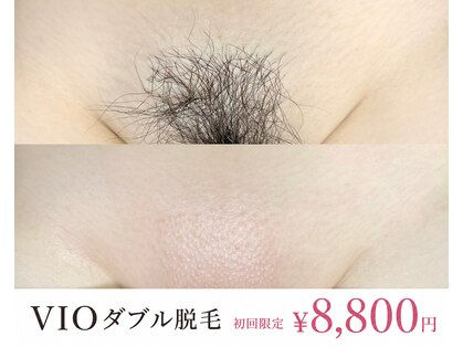 アールビューティー(R Beauty)の写真