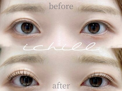 イチル(ichill)の写真