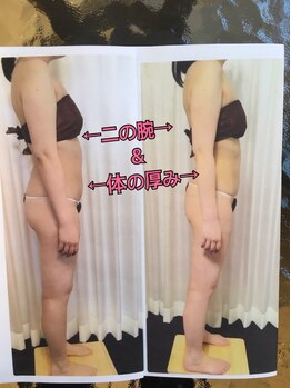 ボディエステティック アクアオーラ 富山店/美ボディへ