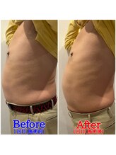 ファビー(Fabby)/マグフォース1回のビフォアフ