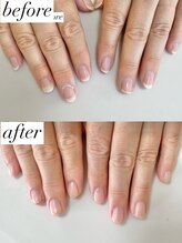 ニコワイズネイル(Nico Y's Nail)/【自爪育成コース】