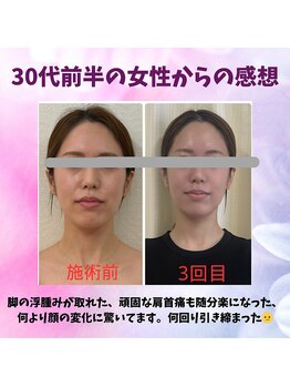 ハナノ整体院/すっかり小顔になりました