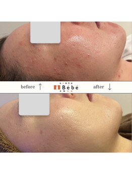 ベベ 大阪中央店(Be’be’)/