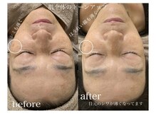 ニコ(25)/ラミピール