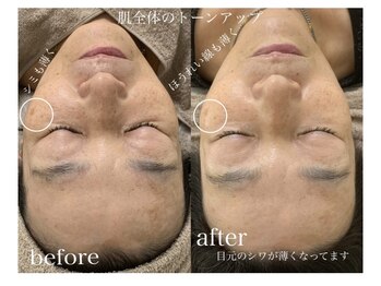 ニコ(25)/ラミピール