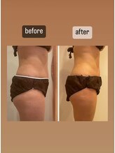 ララ(LALA)/痩身デトックスリンパマッサージ