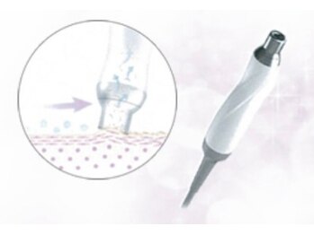 ピティン(Pitin)/ダイヤモンドピーリングとは