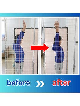 ストレッチヒーロー 倉吉店(STRETCH HERO)/腕を上げる動き