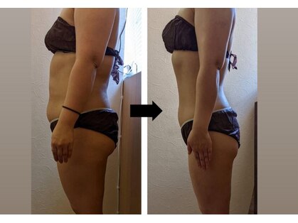 トニートニー(Tony Tony)の写真