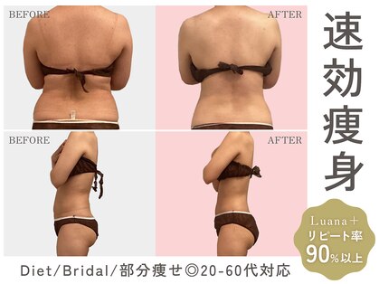 ルアナ プラス(Luana＋)の写真