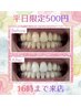 【平日限定/16時迄】セルフホワイトニング(9分2セット)1回¥3,980→¥500