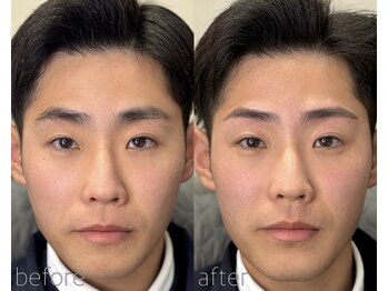 ニュートラル(nutral)/メンズ眉毛デザイン［宮崎］