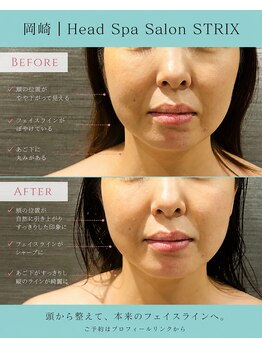 ストリクス(STRIX)/before / after【ヘッドスパ】