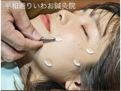 平和通りいわお鍼灸院の写真