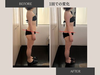リラ(Rela)/before・after