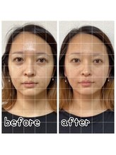 小顔整体 優/お顔のバランスが整う♪