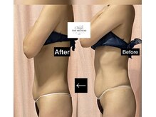 サザンベル 石垣店(SOUTHERN BELLE)の雰囲気（■長年のお悩み☆お任せください☆）