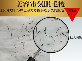 ベルアンドヘルス 千葉(BELL&HEALTH)/確かな技術【美容電気脱毛】
