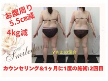 スマイルデイズ(Smiledays)/月に1回の施術、まだ2回目です