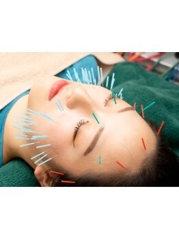 鍼灸施術を受けたい