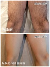 メンズ脱毛サロン ライオン 渋谷(LION)&nbsp;古川 美容部員