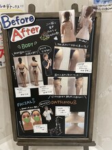 リシャイン(Reshine)/ビフォーアフター写真集☆