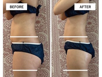 エトワール(etoile)/【引き締まったメリハリボディ】