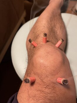 ライズ/Moxa to the knee