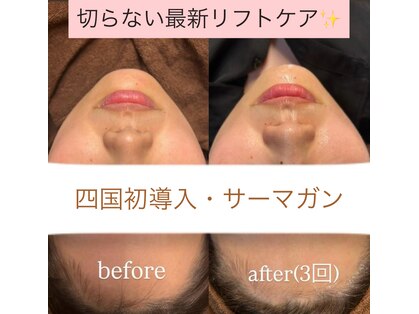 ピュルテの写真