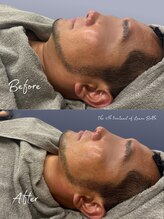 クレビア(CREBIA)/フェイスライン革命