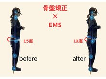 リボーン(REBORN)/整体/骨盤矯正/EMS