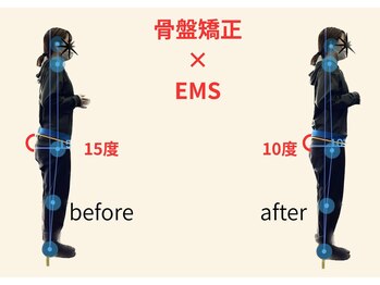 リボーン(REBORN)/整体/骨盤矯正/EMS