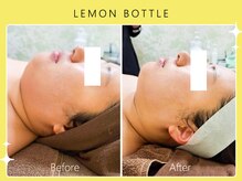 シロカネ イオンタウン西熊本店(SHIROKANE)/小顔コルギ×レモンボトル☆