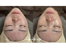 フロラスキン 上野店(florasKIN)/