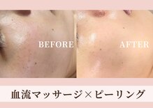 ハナハナ(hanahana)