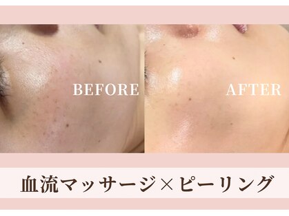 ハナハナ(hanahana)の写真