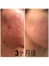 ユウウミ 那覇店(You海)/ラヴィーサビフォーアフター