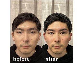 スター 新宿 新宿御苑(★STAR)/施術例メンズアイブロウWAX/新宿