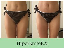 ソルニスデュオ(Solnis.-duo-)/痩身/酵素浴/毛穴/よもぎ蒸し