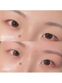アイクチュール 錦糸町店(Eye Couture)/重た目まぶたさん向けデザイン