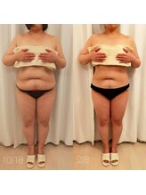 ミールーム(mi room)/痩身エステ３ヶ月半