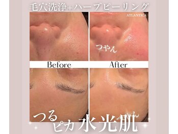 アトランティカ(ATLANTICA)/