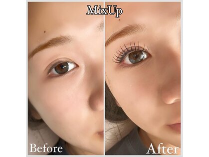 リフト(LIFT)の写真