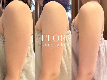 フロル(FLOR)の写真